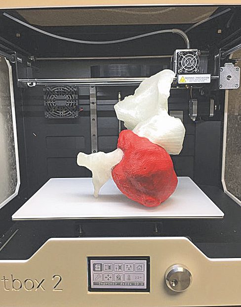  Impresión 3D en hospitales para tratar problemas óseos